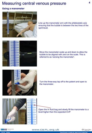 Cvp | PDF