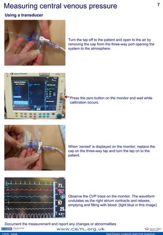 Measuring Cvp With Ruler Cvp | PDF