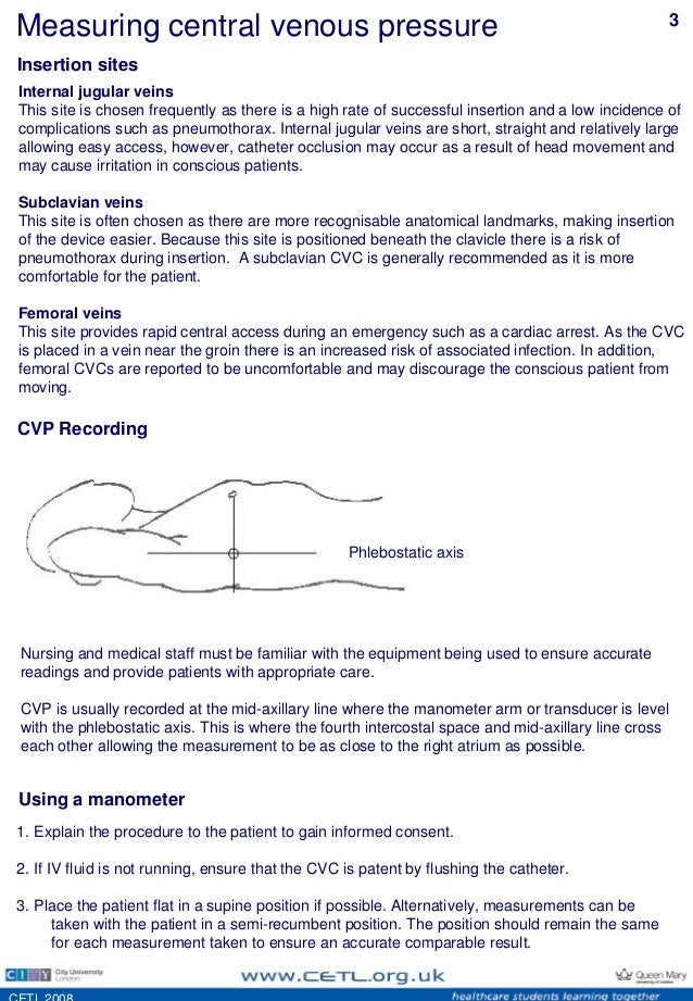 Cvp