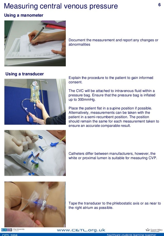 central venous pressure