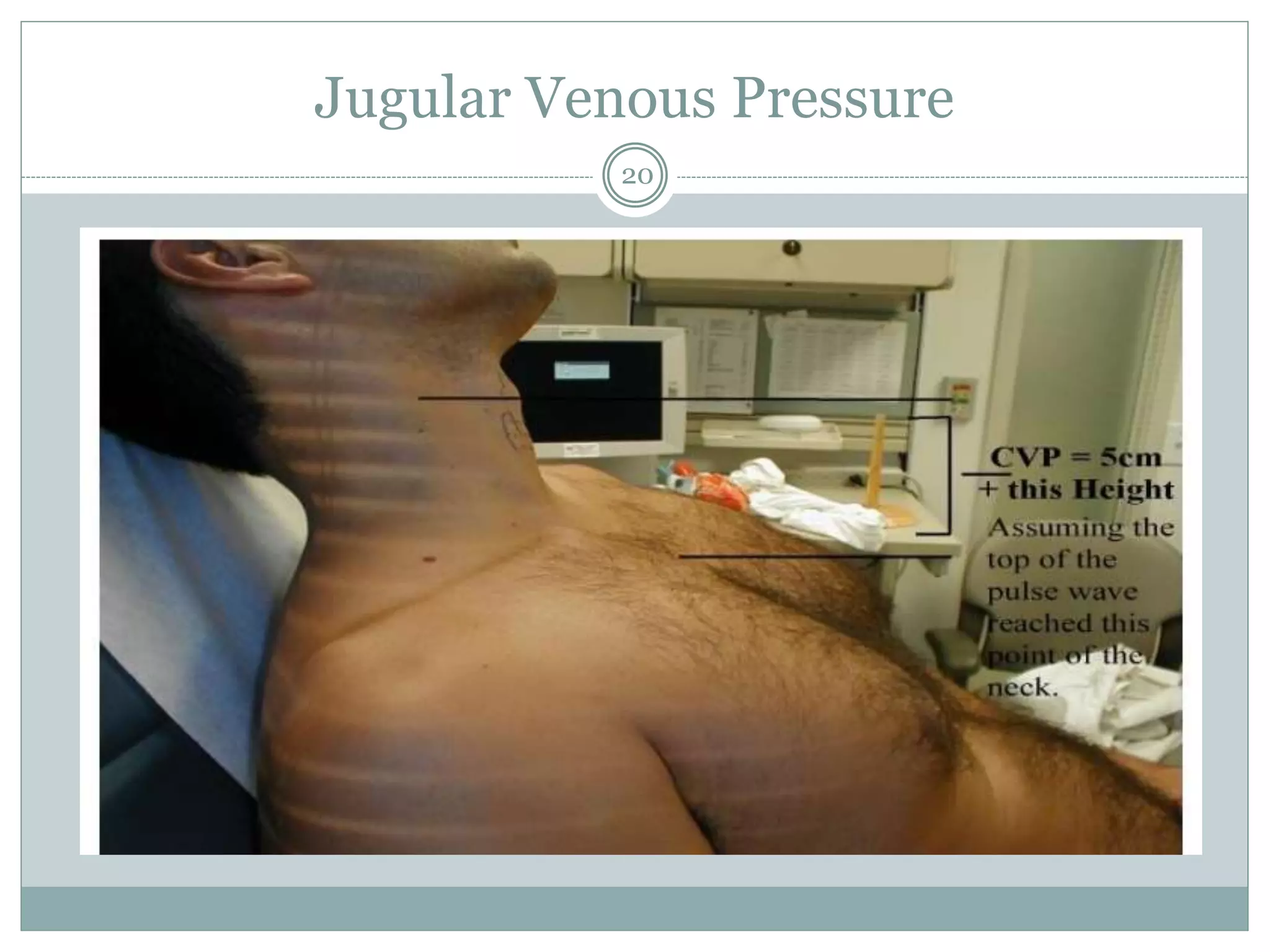 Cv physical exam - Gabriel | PPTX