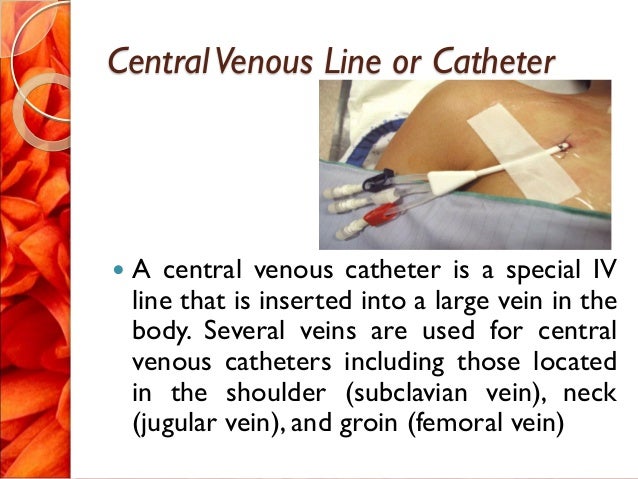 cvp line cv line