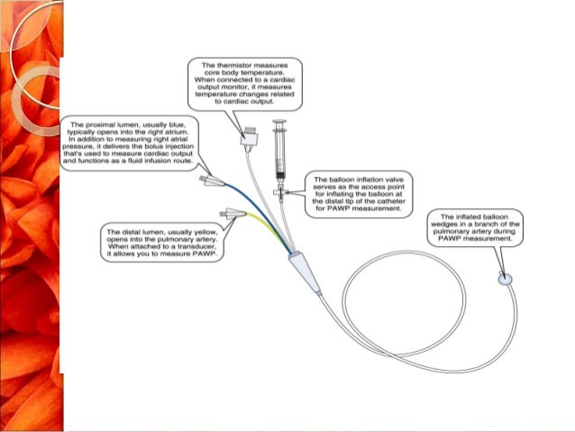 central venous pressure