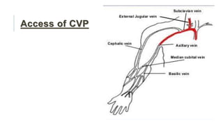 CVP micro teaching.pptx