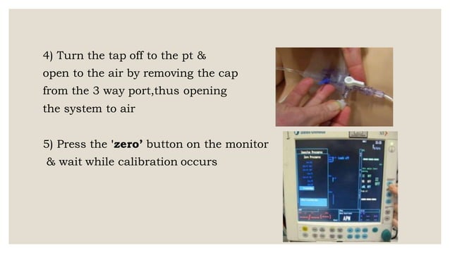 cvp monitoring | PDF