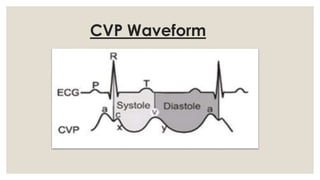 cvp monitoring | PDF
