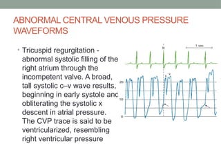 cvp monitoring for medical students - includes all the details | PPTX