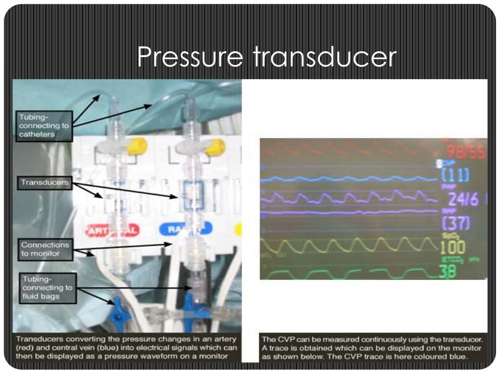 CVP Monitoring_Dr. Subrata Kumar_BSMMU_2014
