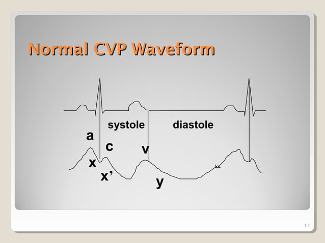 Cvp central venous pressure monitoring | PPT