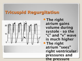 Cvp central venous pressure monitoring | PPT