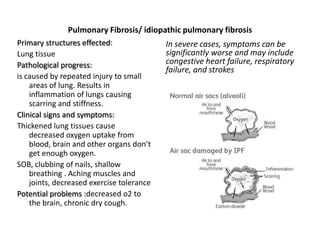 Pulmonary Fibrosis/ idiopathic pulmonary fibrosis
Primary structures effected:               In severe cases, symptoms can be
Lung tissue                                significantly worse and may include
Pathological progress:                     congestive heart failure, respiratory
                                           failure, and strokes
is caused by repeated injury to small
    areas of lung. Results in
    inflammation of lungs causing
    scarring and stiffness.
Clinical signs and symptoms:
Thickened lung tissues cause
    decreased oxygen uptake from
    blood, brain and other organs don’t
    get enough oxygen.
SOB, clubbing of nails, shallow
    breathing . Aching muscles and
    joints, decreased exercise tolerance
Potential problems :decreased o2 to
    the brain, chronic dry cough.
 