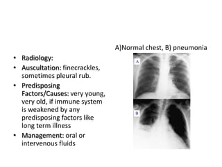 A)Normal chest, B) pneumonia
• Radiology:
• Auscultation: finecrackles,
  sometimes pleural rub.
• Predisposing
  Factors/Causes: very young,
  very old, if immune system
  is weakened by any
  predisposing factors like
  long term illness
• Management: oral or
  intervenous fluids
 