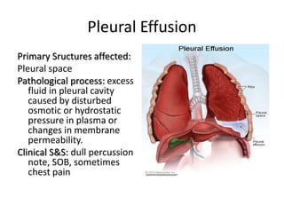 Pleural Effusion
Primary Sructures affected:
Pleural space
Pathological process: excess
   fluid in pleural cavity
   caused by disturbed
   osmotic or hydrostatic
   pressure in plasma or
   changes in membrane
   permeability.
Clinical S&S: dull percussion
   note, SOB, sometimes
   chest pain
 