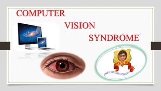 COMPUTER
VISION
SYNDROME
 