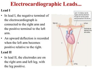 Electrocardiographic Leads...
Lead I
• In lead I, the negative terminal of
the electrocardiograph is
connected to the right arm and
the positive terminal to the left
arm.
• An upward deflection is recorded
when the left arm becomes
positive relative to the right.
Lead II
• In lead II, the electrodes are on
the right arm and left leg, with
the leg positive. 13
 