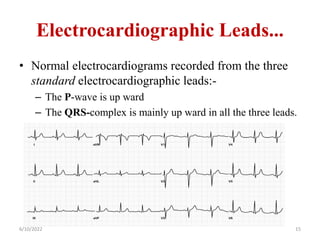 Electrocardiographic Leads...
• Normal electrocardiograms recorded from the three
standard electrocardiographic leads:-
– The P-wave is up ward
– The QRS-complex is mainly up ward in all the three leads.
6/10/2022 15
 