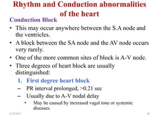 Rhythm and Conduction abnormalities
of the heart
Conduction Block
• This may occur anywhere between the S.A node and
the ventricles.
• A block between the SA node and the AV node occurs
very rarely.
• One of the more common sites of block is A-V node.
• Three degrees of heart block are usually
distinguished:
1. First degree heart block
– PR interval prolonged, >0.21 sec
– Usually due to A-V nodal delay
• May be caused by increased vagal tone or systemic
diseases.
6/10/2022 38
 