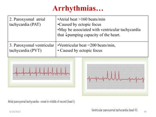 Arrhythmias…
2. Paroxysmal atrial
tachycardia (PAT)
•Atrial beat >160 beats/min
•Caused by ectopic focus
•May be associated with ventricular tachycardia
that pumping capacity of the heart.
3. Paroxysmal ventricular
tachycardia (PVT)
•Ventricular beat =200 beats/min,
• Caused by ectopic focus
6/10/2022 46
 