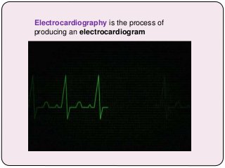Electrocardiography is the process of
producing an electrocardiogram
 