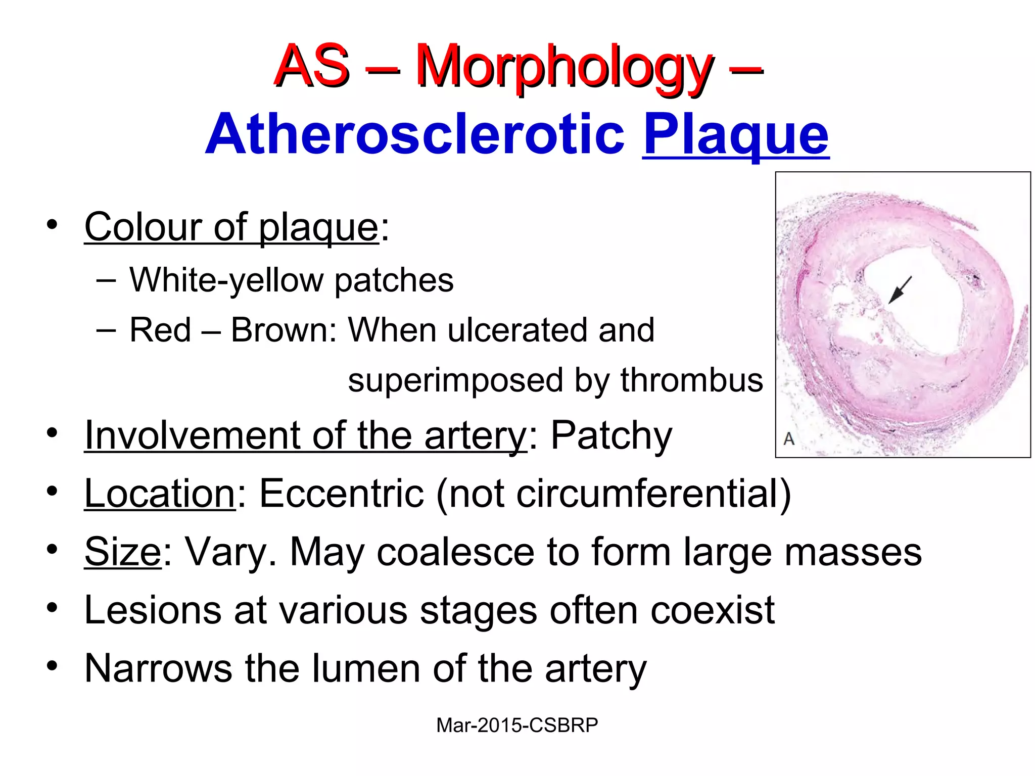 AS – Morphology –AS – Morphology –
Atherosclerotic Plaque
• Colour of plaque:
– White-yellow patches
– Red – Brown: When ulcerated and
superimposed by thrombus
• Involvement of the artery: Patchy
• Location: Eccentric (not circumferential)
• Size: Vary. May coalesce to form large masses
• Lesions at various stages often coexist
• Narrows the lumen of the artery
Mar-2015-CSBRP
 