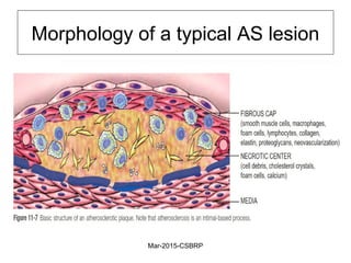 Morphology of a typical AS lesion
Mar-2015-CSBRP
 