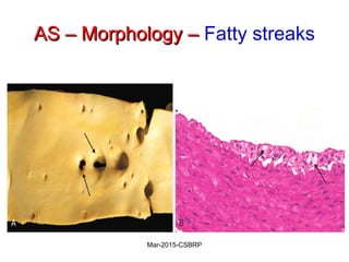 AS – Morphology –AS – Morphology – Fatty streaks
Mar-2015-CSBRP
 