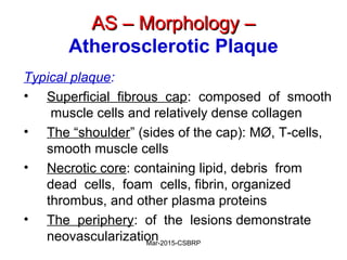 AS – Morphology –AS – Morphology –
Atherosclerotic Plaque
Typical plaque:
• Superficial fibrous cap: composed of smooth
muscle cells and relatively dense collagen
• The “shoulder” (sides of the cap): MØ, T-cells,
smooth muscle cells
• Necrotic core: containing lipid, debris from
dead cells, foam cells, fibrin, organized
thrombus, and other plasma proteins
• The periphery: of the lesions demonstrate
neovascularizationMar-2015-CSBRP
 
