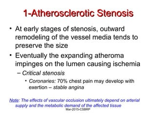 1-Atherosclerotic Stenosis1-Atherosclerotic Stenosis
• At early stages of stenosis, outward
remodeling of the vessel media tends to
preserve the size
• Eventually the expanding atheroma
impinges on the lumen causing ischemia
– Critical stenosis
• Coronaries: 70% chest pain may develop with
exertion – stable angina
Note: The effects of vascular occlusion ultimately depend on arterial
supply and the metabolic demand of the affected tissue
Mar-2015-CSBRP
 