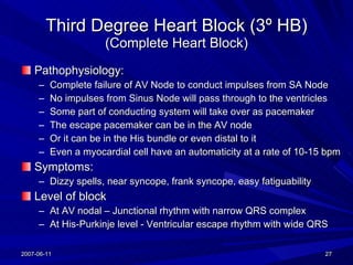 AV Nodal Blocks | PPT