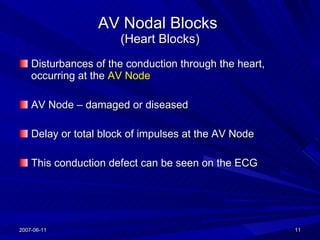 AV Nodal Blocks  (Heart Blocks) <ul><li>Disturbances of the conduction through the heart, occurring at the  AV Node </li><...