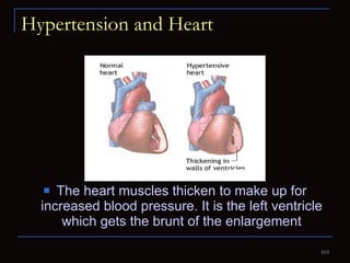 Hypertension and Heart The heart muscles thicken to make up for increased blood pressure. It is the left ventricle which gets the brunt of the enlargement 