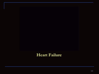 Heart Failure 