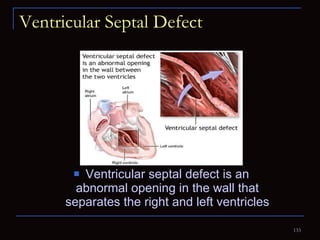 Ventricular Septal Defect Ventricular septal defect is an abnormal opening in the wall that separates the right and left ventricles 