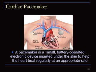 Cardiac Pacemaker A pacemaker is a  small, battery-operated electronic device inserted under the skin to help the heart beat regularly at an appropriate rate 