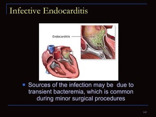 Infective Endocarditis Sources of the infection may be  due to transient bacteremia, which is common during minor surgical procedures 