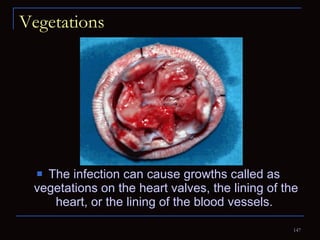 Vegetations The infection can cause growths called as  vegetations on the heart valves, the lining of the heart, or the lining of the blood vessels.  