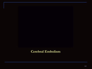 Cerebral Embolism 