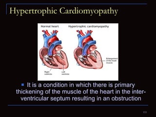Hypertrophic Cardiomyopathy It is a condition in which there is primary thickening of the muscle of the heart in the inter-ventricular septum resulting in an obstruction 