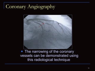 Coronary Angiography The narrowing of the coronary vessels can be demonstrated using this radiological technique  