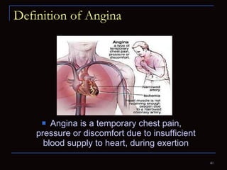 Definition of Angina Angina is a temporary chest pain, pressure or discomfort due to insufficient blood supply to heart, during exertion 