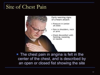 Site of Chest Pain The chest pain in angina is felt in the center of the chest, and is described by an open or closed fist showing the site 