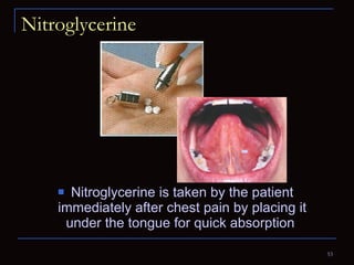 Nitroglycerine Nitroglycerine is taken by the patient immediately after chest pain by placing it under the tongue for quick absorption  