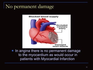 No permanent damage In angina there is no permanent damage to the myocardium as would occur in patients with Myocardial Infarction  