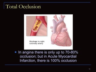 Total Occlusion  In angina there is only up to 70-80% occlusion; but in Acute Myocardial Infarction, there is 100% occlusion 