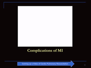 Complications of MI Coming up a Video of Cardio Pulmonary Resuscitation 