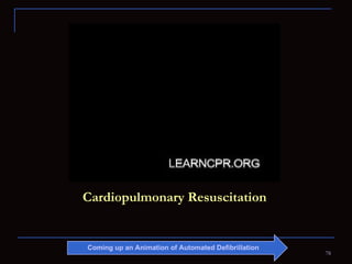 Cardiopulmonary Resuscitation Coming up an Animation of Automated Defibrillation  