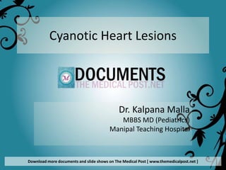 Cyanotic Heart Lesions




                                             Dr. Kalpana Malla
                                            MBBS MD (Pediatrics)
                                         Manipal Teaching Hospital



Download more documents and slide shows on The Medical Post [ www.themedicalpost.net ]
 