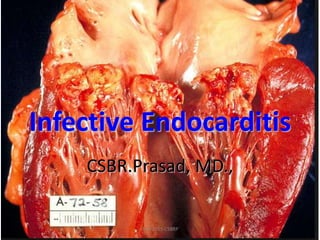 Infective Endocarditis
CSBR.Prasad, MD.,
APR-2015-CSBRP
 