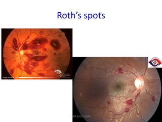 Old Roth Spots Cvs ie-csbrp | PPTX