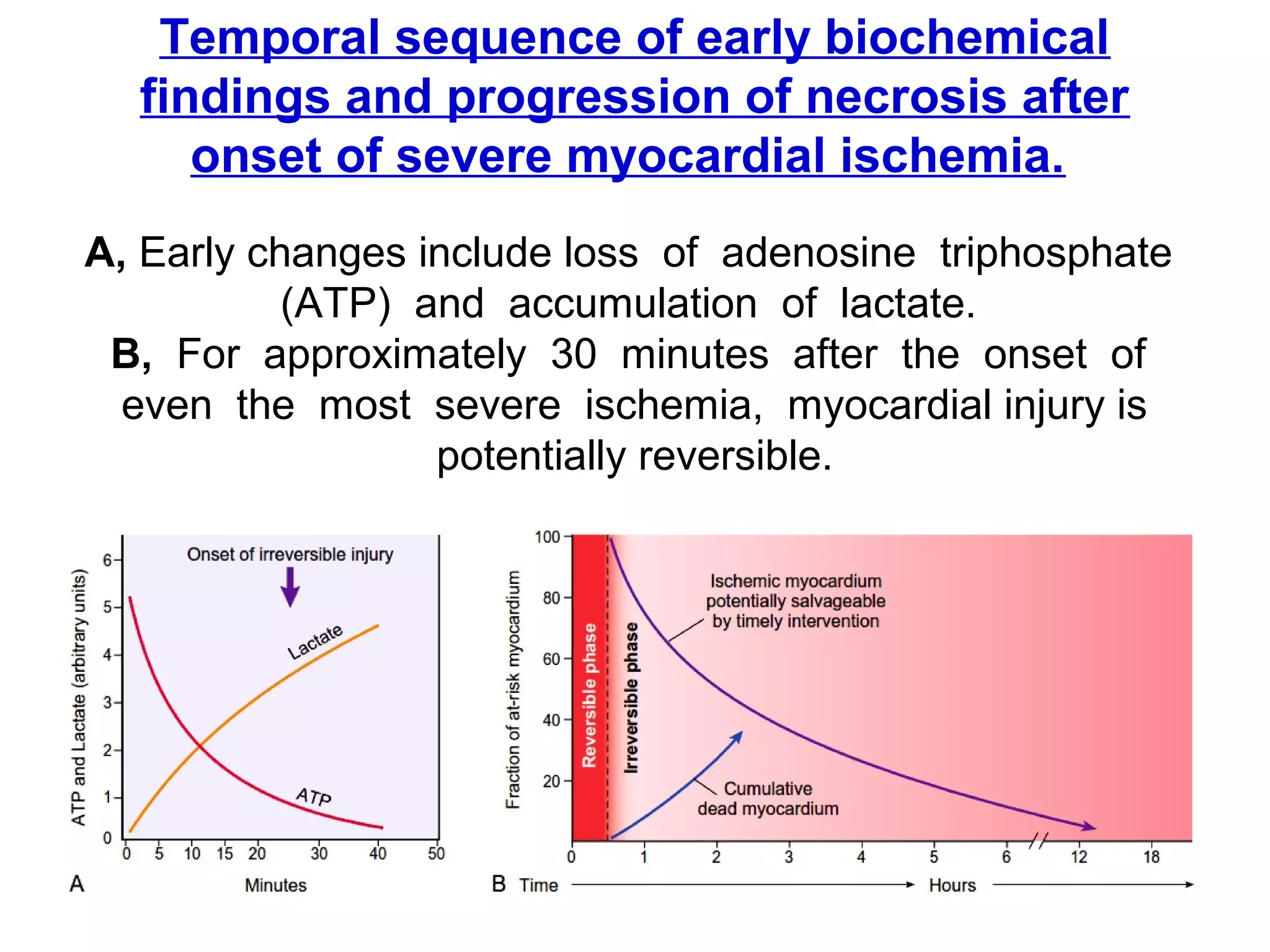 v1-NOV-2014-CSBRP
Temporal sequence of early biochemical
findings and progression of necrosis after
onset of severe myocardial ischemia.
A, Early changes include loss of adenosine triphosphate
(ATP) and accumulation of lactate.
B, For approximately 30 minutes after the onset of
even the most severe ischemia, myocardial injury is
potentially reversible.
 
